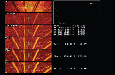 Retinal Scanner